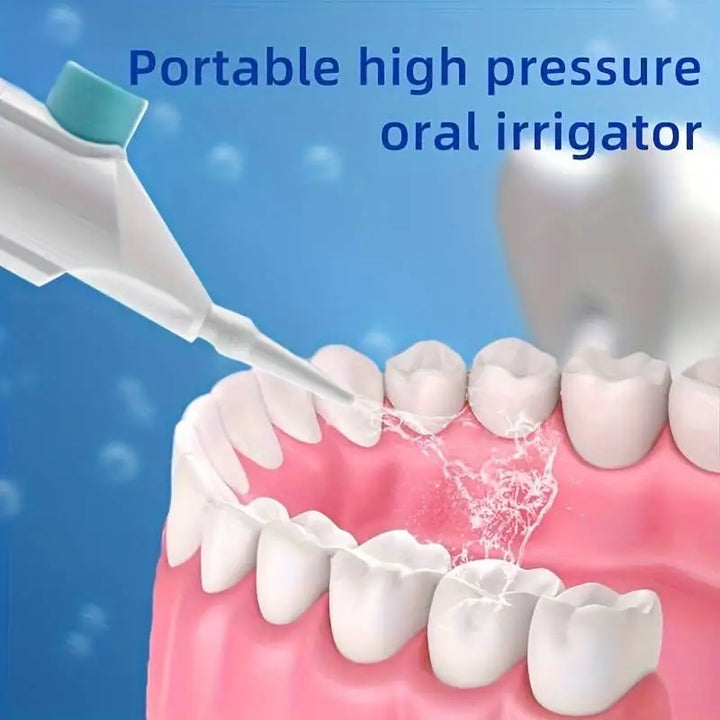 Portable High-Pressure Oral Irrigator